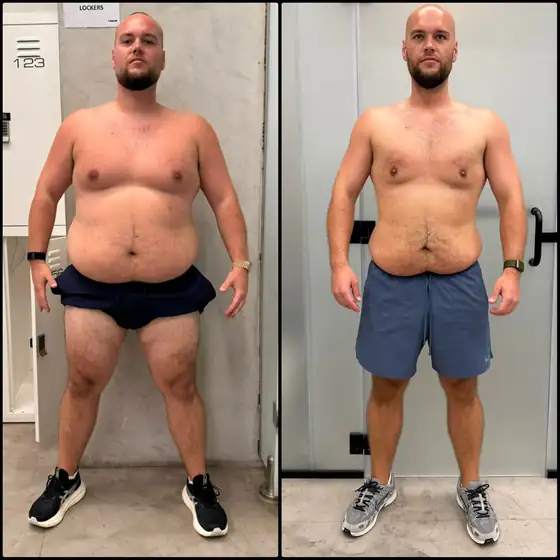 Client before and after, result 1