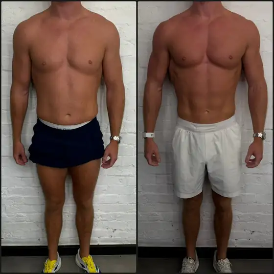 Client before and after, result 5